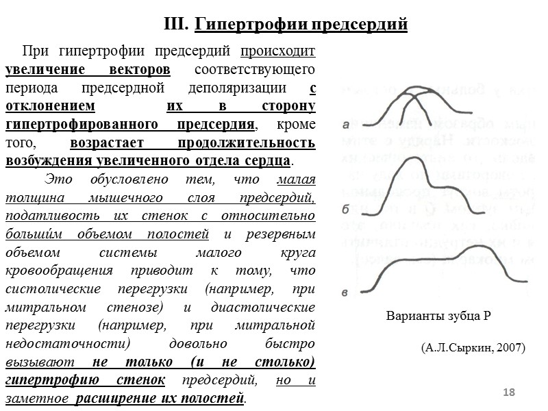 18 III. Гипертрофии предсердий При гипертрофии предсердий происходит увеличение 18 III. Гипертрофии предсердий При гипертрофии предсердий происходит увеличение